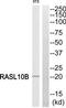 RAS Like Family 10 Member B antibody, TA315982, Origene, Western Blot image 