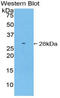 Receptor Interacting Serine/Threonine Kinase 3 antibody, LS-C296195, Lifespan Biosciences, Western Blot image 