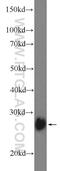 Thiamin pyrophosphokinase 1 antibody, 10942-1-AP, Proteintech Group, Western Blot image 