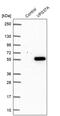 VPS37A Subunit Of ESCRT-I antibody, PA5-55182, Invitrogen Antibodies, Western Blot image 