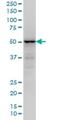 Tripartite Motif Containing 49 antibody, H00057093-M05, Novus Biologicals, Western Blot image 