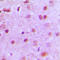 Nuclear Transcription Factor Y Subunit Alpha antibody, LS-C352582, Lifespan Biosciences, Immunohistochemistry paraffin image 