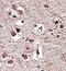 Glutamate Metabotropic Receptor 2 antibody, orb125026, Biorbyt, Immunohistochemistry paraffin image 