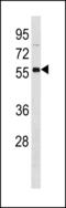 3-Oxoacid CoA-Transferase 2 antibody, LS-C203873, Lifespan Biosciences, Western Blot image 