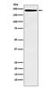 Lymphocyte Antigen 75 antibody, M08183, Boster Biological Technology, Western Blot image 