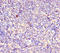 Receptor Interacting Serine/Threonine Kinase 2 antibody, A54388-100, Epigentek, Immunohistochemistry paraffin image 