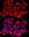 Clathrin Heavy Chain antibody, 14-413, ProSci, Immunofluorescence image 