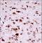 Phosphorylase Kinase Catalytic Subunit Gamma 2 antibody, LS-C164528, Lifespan Biosciences, Immunohistochemistry frozen image 