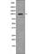 Toll Like Receptor 5 antibody, PA5-64723, Invitrogen Antibodies, Western Blot image 