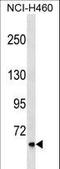 Chloride Voltage-Gated Channel Ka antibody, LS-C159362, Lifespan Biosciences, Western Blot image 