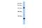 Terminal Uridylyl Transferase 1, U6 SnRNA-Specific antibody, PA5-41630, Invitrogen Antibodies, Western Blot image 