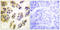 Cbl Proto-Oncogene antibody, LS-C198744, Lifespan Biosciences, Immunohistochemistry paraffin image 