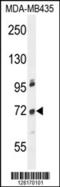 Zinc Finger Protein 510 antibody, 55-453, ProSci, Western Blot image 