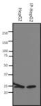 Superoxide Dismutase 2 antibody, GTX31147, GeneTex, Immunoprecipitation image 