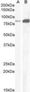 Cholecystokinin B Receptor antibody, GTX89402, GeneTex, Western Blot image 