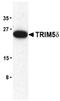 Tripartite motif-containing protein 5 antibody, LS-C351, Lifespan Biosciences, Western Blot image 