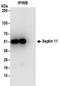 Septin 11 antibody, NBP2-32160, Novus Biologicals, Immunoprecipitation image 