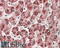 Lemur Tyrosine Kinase 2 antibody, 42-650, ProSci, Western Blot image 
