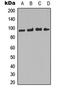 Forkhead Box O3 antibody, LS-C368596, Lifespan Biosciences, Western Blot image 