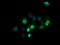 Zinc Finger And SCAN Domain Containing 21 antibody, M11874, Boster Biological Technology, Immunofluorescence image 