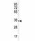 Immunoglobulin Heavy Constant Alpha 1 antibody, F50424-0.4ML, NSJ Bioreagents, Western Blot image 