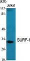 SURF1 Cytochrome C Oxidase Assembly Factor antibody, A03678, Boster Biological Technology, Western Blot image 