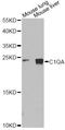 Complement C1q A Chain antibody, A1821, ABclonal Technology, Western Blot image 