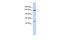 Splicing Factor 3b Subunit 1 antibody, GTX47328, GeneTex, Western Blot image 