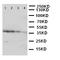 Eukaryotic Translation Initiation Factor 2 Alpha Kinase 2 antibody, LS-C313154, Lifespan Biosciences, Western Blot image 