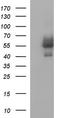 Ankyrin repeat and MYND domain-containing protein 2 antibody, TA507304, Origene, Western Blot image 