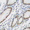 Tau Tubulin Kinase 2 antibody, A05821-1, Boster Biological Technology, Immunohistochemistry paraffin image 