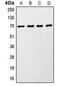 Ribosomal Protein S6 Kinase B1 antibody, MBS822162, MyBioSource, Western Blot image 