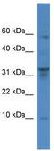 Dipeptidyl transferase antibody, TA342846, Origene, Western Blot image 