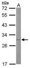 Steroidogenic Acute Regulatory Protein antibody, TA308393, Origene, Western Blot image 