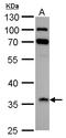 Insulin-like growth factor-binding protein 2 antibody, GTX128977, GeneTex, Western Blot image 