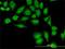 Thioredoxin antibody, H00007295-M01, Novus Biologicals, Immunofluorescence image 