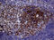 POU Class 2 Homeobox Associating Factor 1 antibody, M04431-2, Boster Biological Technology, Immunohistochemistry paraffin image 