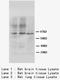 ADAM Metallopeptidase With Thrombospondin Type 1 Motif 4 antibody, LS-C172047, Lifespan Biosciences, Western Blot image 