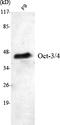 POU Class 5 Homeobox 1 antibody, STJ98523, St John