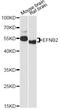 Ephrin B2 antibody, LS-C748029, Lifespan Biosciences, Western Blot image 