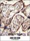 Insulin Like Growth Factor 2 antibody, 55-712, ProSci, Immunohistochemistry paraffin image 