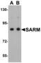 Sterile alpha and TIR motif-containing protein 1 antibody, NBP1-77200, Novus Biologicals, Western Blot image 