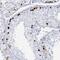 SSX2A antibody, NBP2-46717, Novus Biologicals, Immunohistochemistry frozen image 
