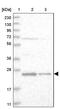 VHL Binding Protein 1 antibody, PA5-54725, Invitrogen Antibodies, Western Blot image 