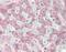 Nuclear Factor Kappa B Subunit 1 antibody, orb216169, Biorbyt, Immunohistochemistry paraffin image 