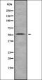 Catalase antibody, orb334965, Biorbyt, Western Blot image 