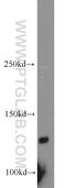 Pleckstrin Homology Domain Containing A5 antibody, 13045-1-AP, Proteintech Group, Western Blot image 