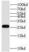 Cytochrome C Oxidase Assembly Factor 7 (Putative) antibody, FNab01062, FineTest, Western Blot image 