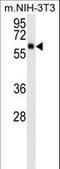 AKT Serine/Threonine Kinase 3 antibody, LS-C156237, Lifespan Biosciences, Western Blot image 