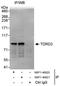 Tudor Domain Containing 3 antibody, NBP1-46820, Novus Biologicals, Immunoprecipitation image 